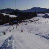Tockneralmlift